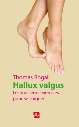 Hallux valgus